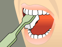 Brushing diagram: clean the outer, inner, and chewing surfaces
